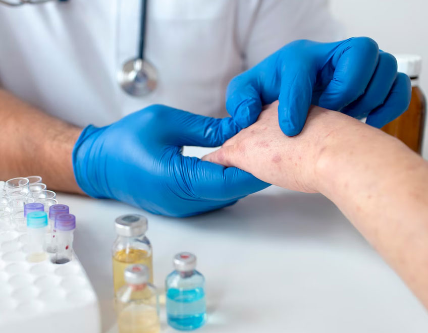 Dermatology
